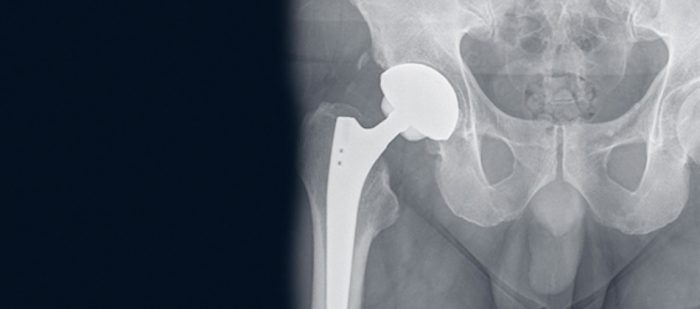 Dr. Thomas Hofstädter - MBA Orthopäde, Gelenkchrirug und Sportarzt
